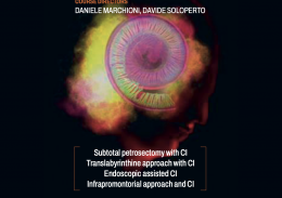 All around cochlear implant